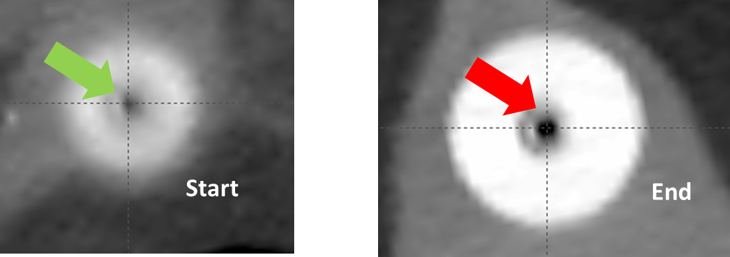 Two-Point Method