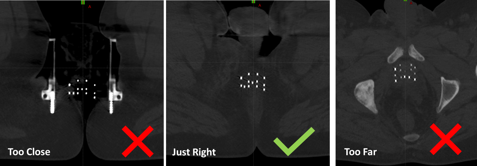 Axial Slice