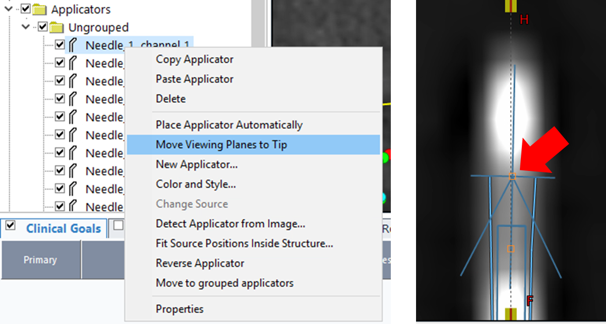 Adjust Tips