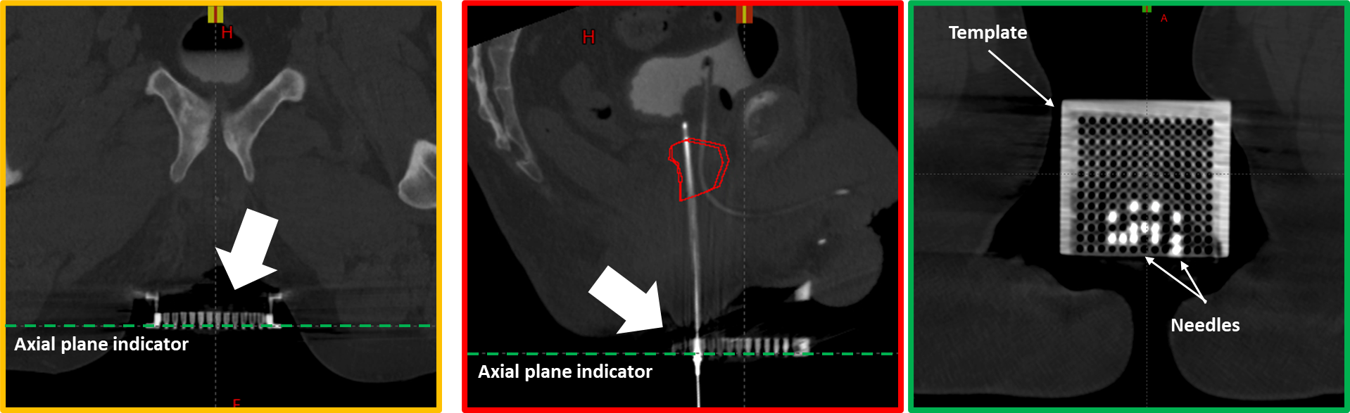Align CT