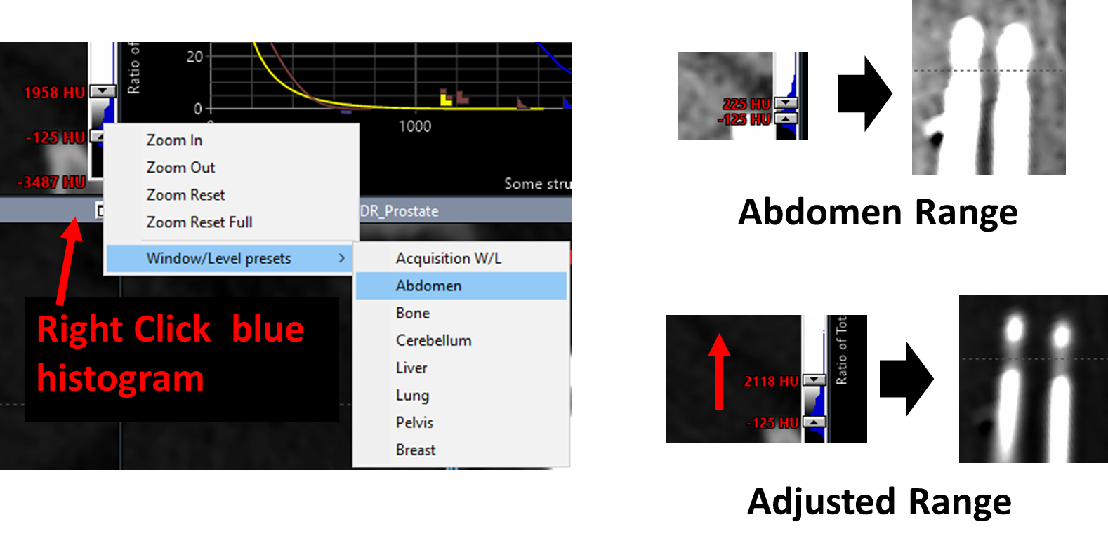 CT Optimization